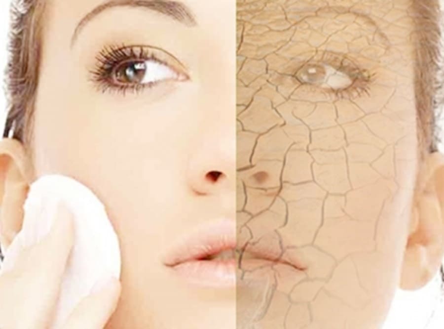 Dry Skin Care